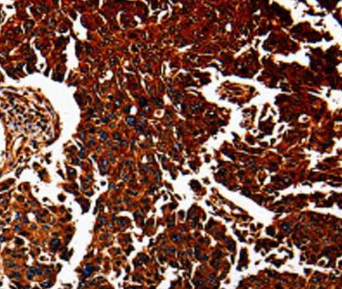 Anti-Human/Mouse ANXA7 Antibody