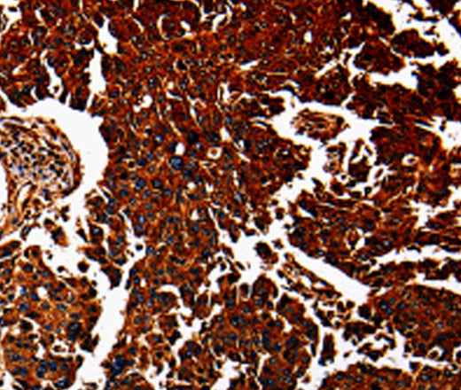 Anti-Human/Mouse ANXA7 Antibody - ABMIUM