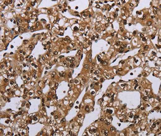 Anti-Human/Mouse MEIS1 Antibody