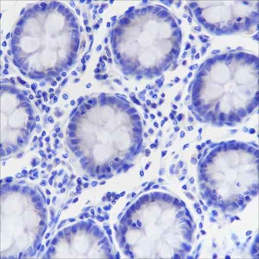 Anti-Human Napsin A Antibody [A312]