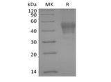 Recombinant Human Signal Transducer CD24/CD24 (C-mFC) - ABMIUM