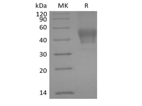 Recombinant Human Signal Transducer CD24/CD24 (C-mFC) - ABMIUM