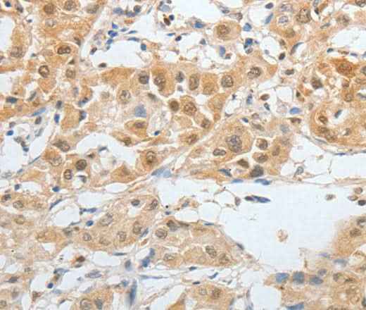 Anti-Human/Mouse BPIFB2 Antibody