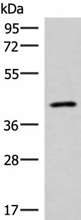Western blot analysis of Human abdominal interstitial sarcoma tissue lysate using SLC16A7 Polyclonal Antibody at dilution of 1:400