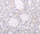 Anti-Human TSHR Antibody - ABMIUM