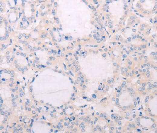 Anti-Human TSHR Antibody
