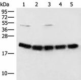 Western blot analysis of Raji cell Mouse brain tissue Hela A375 and 231 cell lysates using ARF5 Polyclonal Antibody at dilution of 1:400