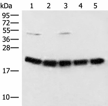 Western blot analysis of Raji cell Mouse brain tissue Hela A375 and 231 cell lysates using ARF5 Polyclonal Antibody at dilution of 1:400