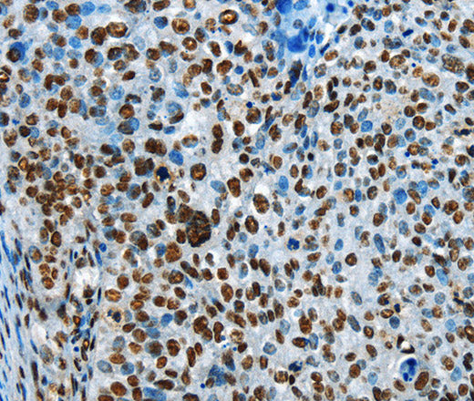 Anti-Human/Mouse/Rat CREB1 Antibody - ABMIUM