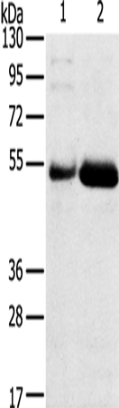 Anti-Human SAMD3 Antibody - ABMIUM