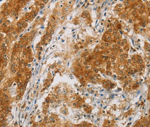 Anti-Human/Mouse CENPE Antibody - ABMIUM