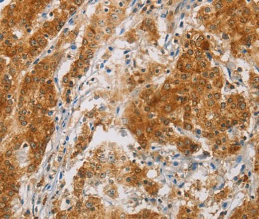 Anti-Human/Mouse CENPE Antibody - ABMIUM