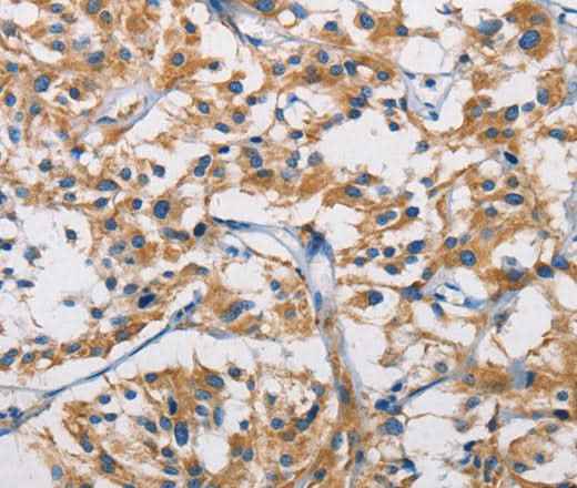 Anti-Human/Mouse/Rat HK1 Antibody