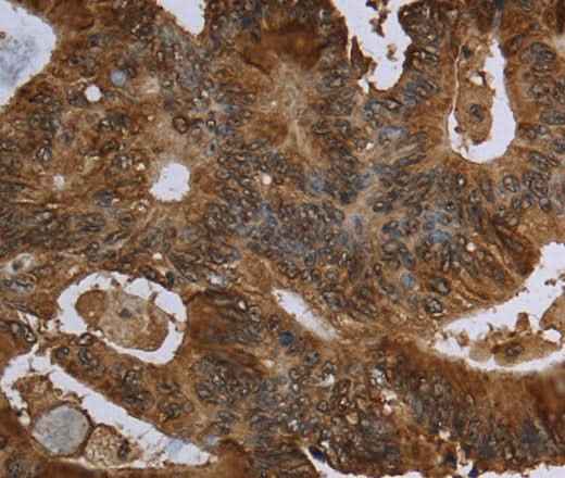Anti-Human/Mouse/Rat HPGD Antibody