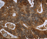 Anti-Human/Mouse/Rat HPGD Antibody - ABMIUM