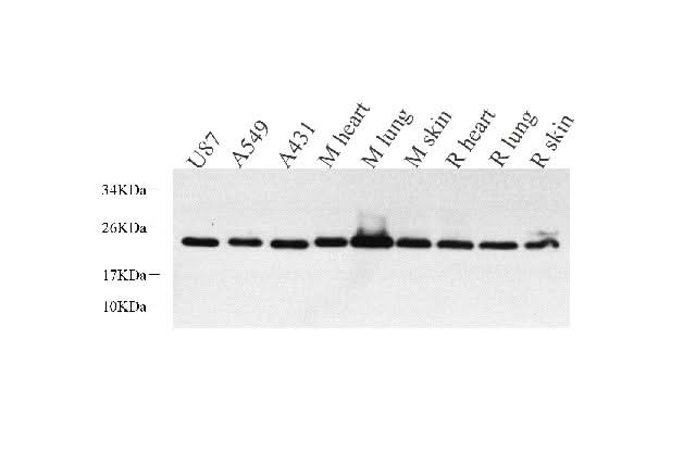 Western Blot analysis of various samples using CAV1 Polyclonal Antibody at dilution of 1:800.