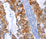 Anti-Human/Mouse/Rat ARRB1 Antibody - ABMIUM