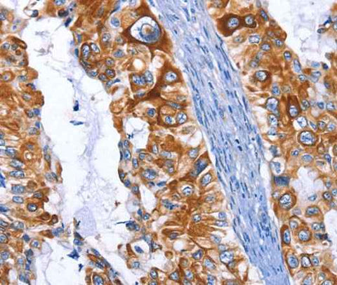 Anti-Human/Mouse/Rat ARRB1 Antibody