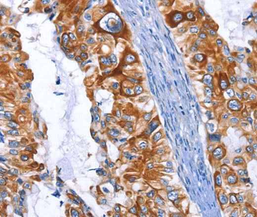 Anti-Human/Mouse/Rat ARRB1 Antibody