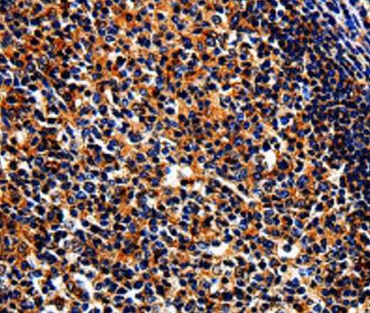 Anti-Human/Mouse BIRC6 Antibody - ABMIUM