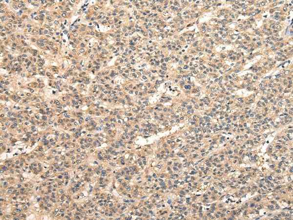 Anti-Human/Mouse/Rat VPS33B Antibody