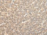 Anti-Human/Mouse/Rat VPS33B Antibody - ABMIUM