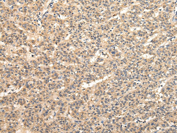 Anti-Human/Mouse/Rat VPS33B Antibody - ABMIUM