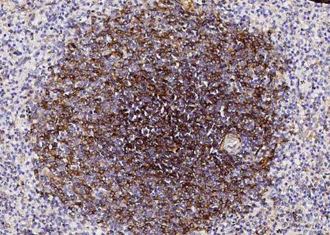 Anti-Human NT5E Antibody [B275] - ABMIUM