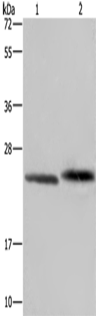 Anti-Human/Mouse/Rat GLO1 Antibody - ABMIUM