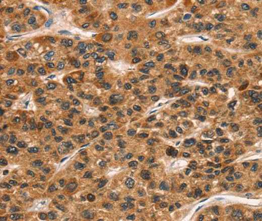 Anti-Human CD159a/c Antibody - ABMIUM