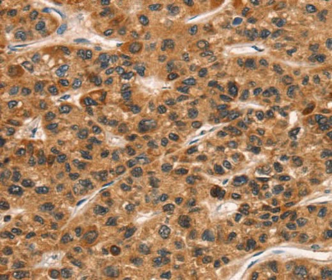 Anti-Human CD159a/c Antibody - ABMIUM