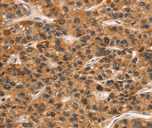 Anti-Human CD159a/c Antibody - ABMIUM