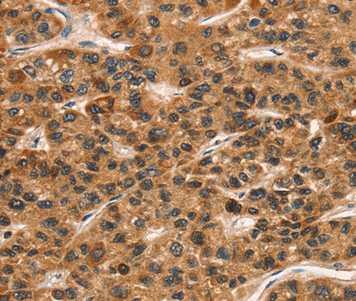 Anti-Human CD159a/c Antibody - ABMIUM