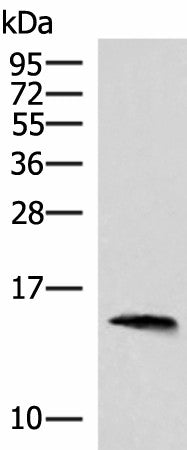 Western blot analysis of Human pancreas tissue lysate using REG1B Polyclonal Antibody at dilution of 1:800
