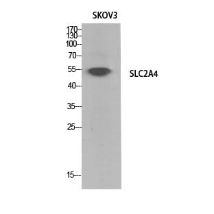 Western Blot analysis of SKOV3 cells using GLUT-4 Polyclonal Antibody at dilution of 1:1000.