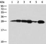 Western blot analysis of 293T cell Human bladder transitional cell carcinoma grade 2-3 tissue lysate MCF-7 cell lysates using MMAB Polyclonal Antibody at dilution of 1:1400