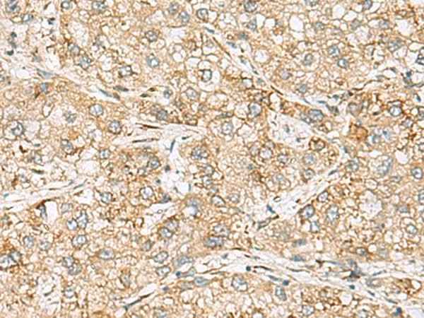 Anti-Human/Mouse/Rat SH3GL2 Antibody