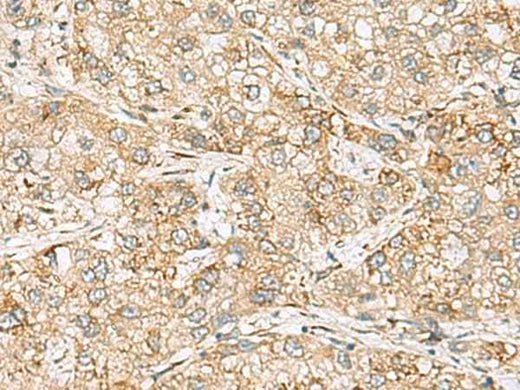 Anti-Human/Mouse/Rat SH3GL2 Antibody