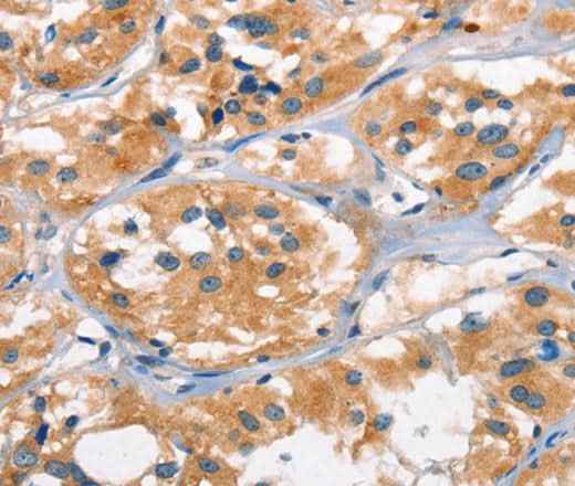 Anti-Human/Mouse/Rat AHR Antibody