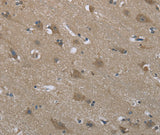 Anti-Human/Mouse/Rat SYT3 Antibody - ABMIUM