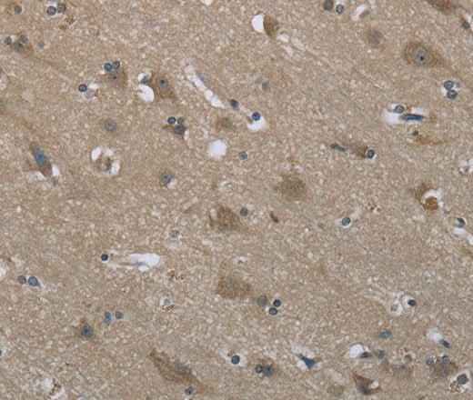 Anti-Human/Mouse/Rat SYT3 Antibody