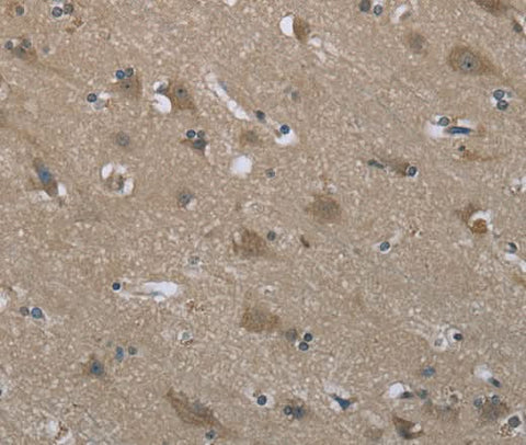 Anti-Human/Mouse/Rat SYT3 Antibody - ABMIUM