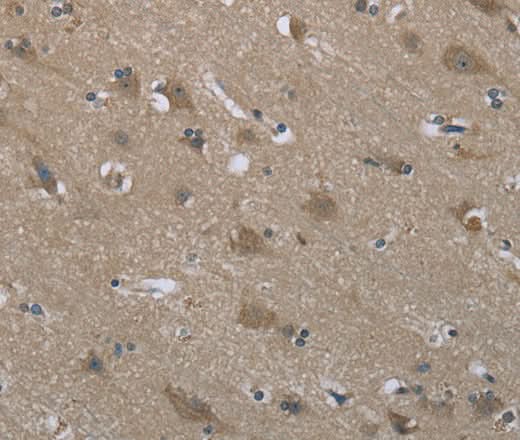 Anti-Human/Mouse/Rat SYT3 Antibody - ABMIUM
