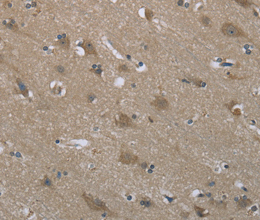 Anti-Human/Mouse/Rat SYT3 Antibody - ABMIUM