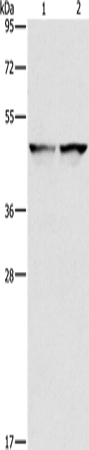 Anti-Human/Mouse/Rat IDH1 Antibody - ABMIUM