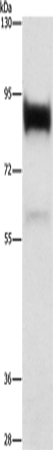 Anti-Human LTF Antibody - ABMIUM