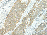 Anti-Human ETAA1 Antibody - ABMIUM
