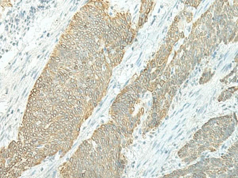 Anti-Human ETAA1 Antibody - ABMIUM