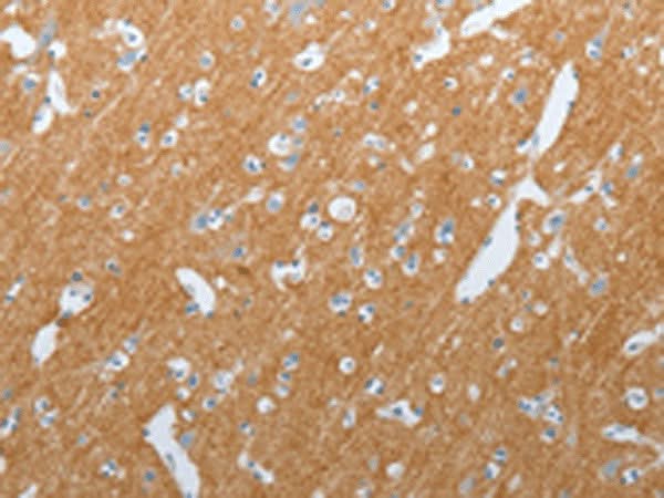 Immunohistochemistry of paraffin-embedded Human brain tissue using SLC17A7 Polyclonal Antibody at dilution of 1:200(×200)