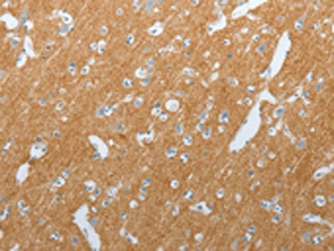 Immunohistochemistry of paraffin-embedded Human brain tissue using SLC17A7 Polyclonal Antibody at dilution of 1:200(×200)